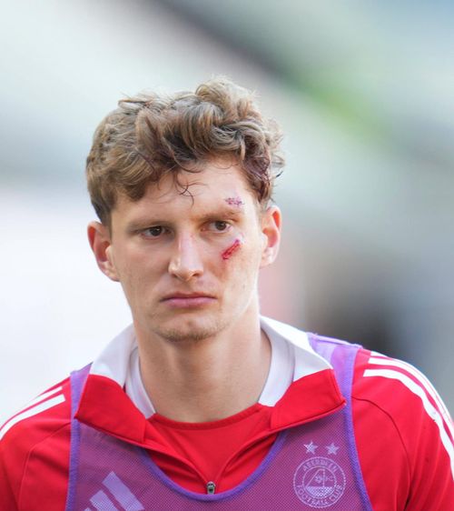 Atacat de propriii fani    FOTO VIDEO.  Horror! Un jucător al lui Aberdeen a fost   lovit în față  de un suporter al echipei sale