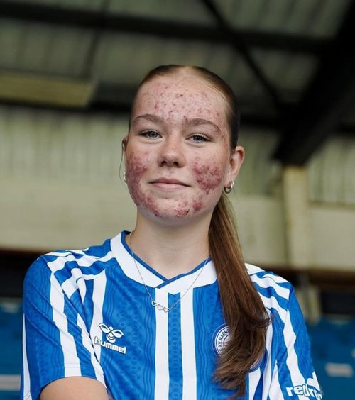 Adolescentă atacată pentru cum arată     Fotbalista de doar 16 ani  a fost apărată de mai multe personalități, după ce a fost luată la țintă online