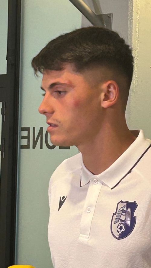 Cum arată Mario Tudose după ce a fost lovit de Ngezana FOTO GOLAZO.ro