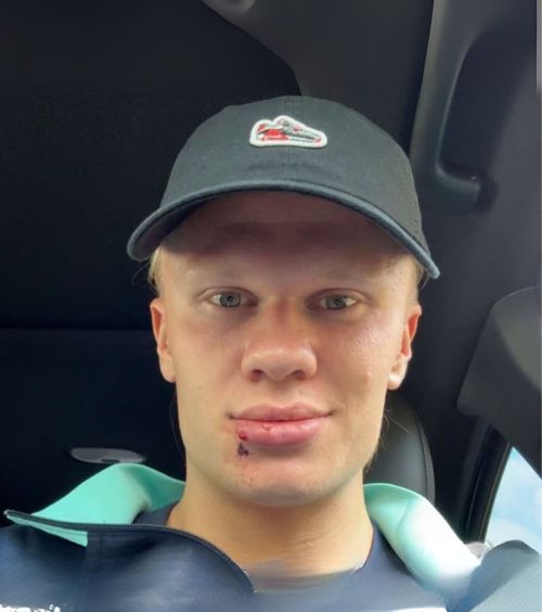 Haaland, accident straniu     Ce a pățit atacantul norvegian  în cantonamentul naționalei