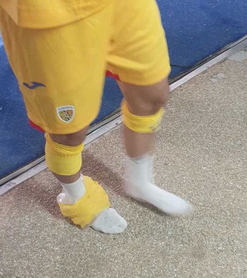 Probleme pentru FCSB  Campioanei României i s-a accidentat unul dintre   jucătorii de bază:  „Îl doare când merge”