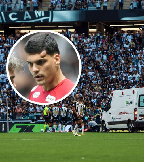 Lovit cu genunchiul în cap    FOTO.  Portarul echipei Santos s-a ales cu un   cucui imens.  Mesaj de pe patul de spital