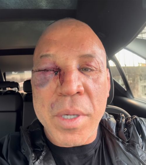 Atacat de fiul adversarului  A revenit în ring la 49 de ani și   a ajuns la spital după meci!  Legenda UFC, lăsată inconștientă de o lovitură brutală