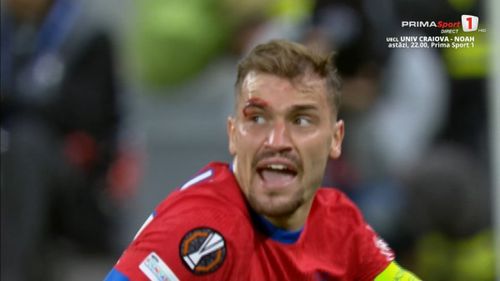 Darius Olaru, lovit dur în FCSB - Bologna