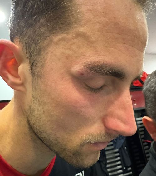 Are dreptate Ilyeș?    FOTO:  Cum arată Eppel după   lovitura încasată  de la Boateng: „Nu poți să nu chemi la VAR”