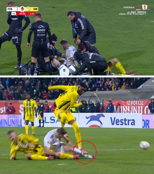 Kovtaliuk, accidentare gravă    FOTO:  Boateng a scăpat nesancționat după faultul care l-a scos din circuit pe atacantul de la Botoșani:   „Scandalos!”