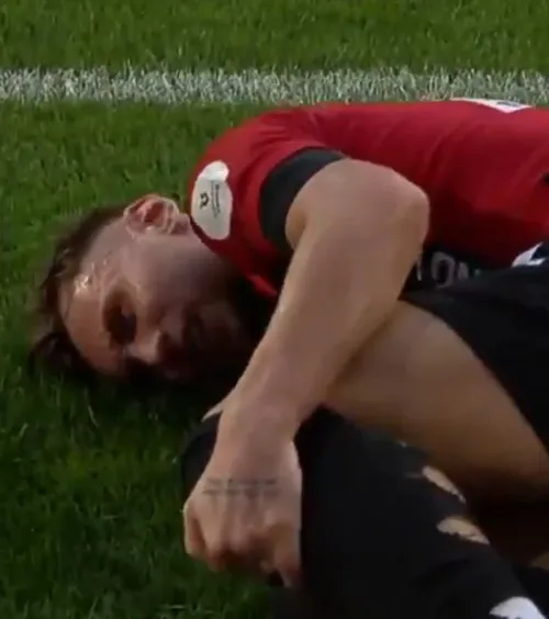 Drăguș, accidentare gravă     FOTO + VIDEO.     Ce a pățit  atacantul echipei naționale