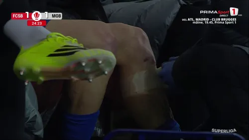 FCSB - Metaloglobus, accidentare Florin Tănase (21).jpg