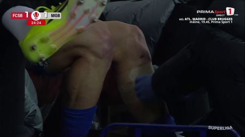 FCSB - Metaloglobus, accidentare Florin Tănase (22).jpg