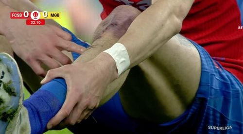 Florin Tănase, probleme medicale în FCSB - Metaloglobus FOTO Captură Prima Sport (5).jpeg