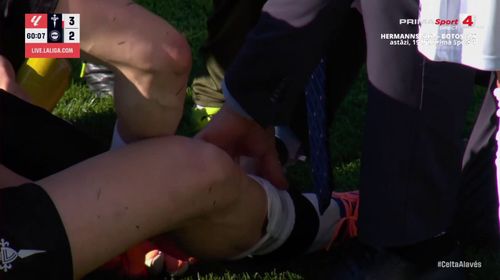 Accidentarea lui Ionut Radu in Celta - Alaves (9).jpg