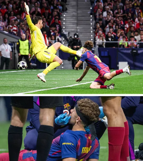 Incident horror    FOTO.  Momentul în care Fermin Lopez   este lovit cu gheata în față   în meciul Atletico - Barcelona. S-a umplut de sânge!