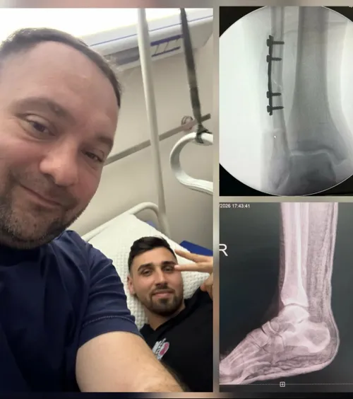 Caz unic în fotbalul românesc     Are fractură de peroneu,  dar a pledat pentru reducerea suspendării agresorului: „Au fost corecți”