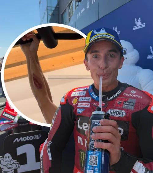 Marquez, poză tulburătoare   FOTO:  Campionul mondial din MotoGP  și-a șocat fanii cu imaginea pe care a publicat-o