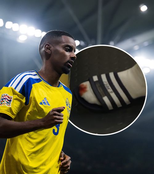 „Cicatrici de luptă”   FOTO.  Alexander Isak, cu  piciorul însângerat  după Suedia - România. Cine l-a rănit pe starul lui Liverpool