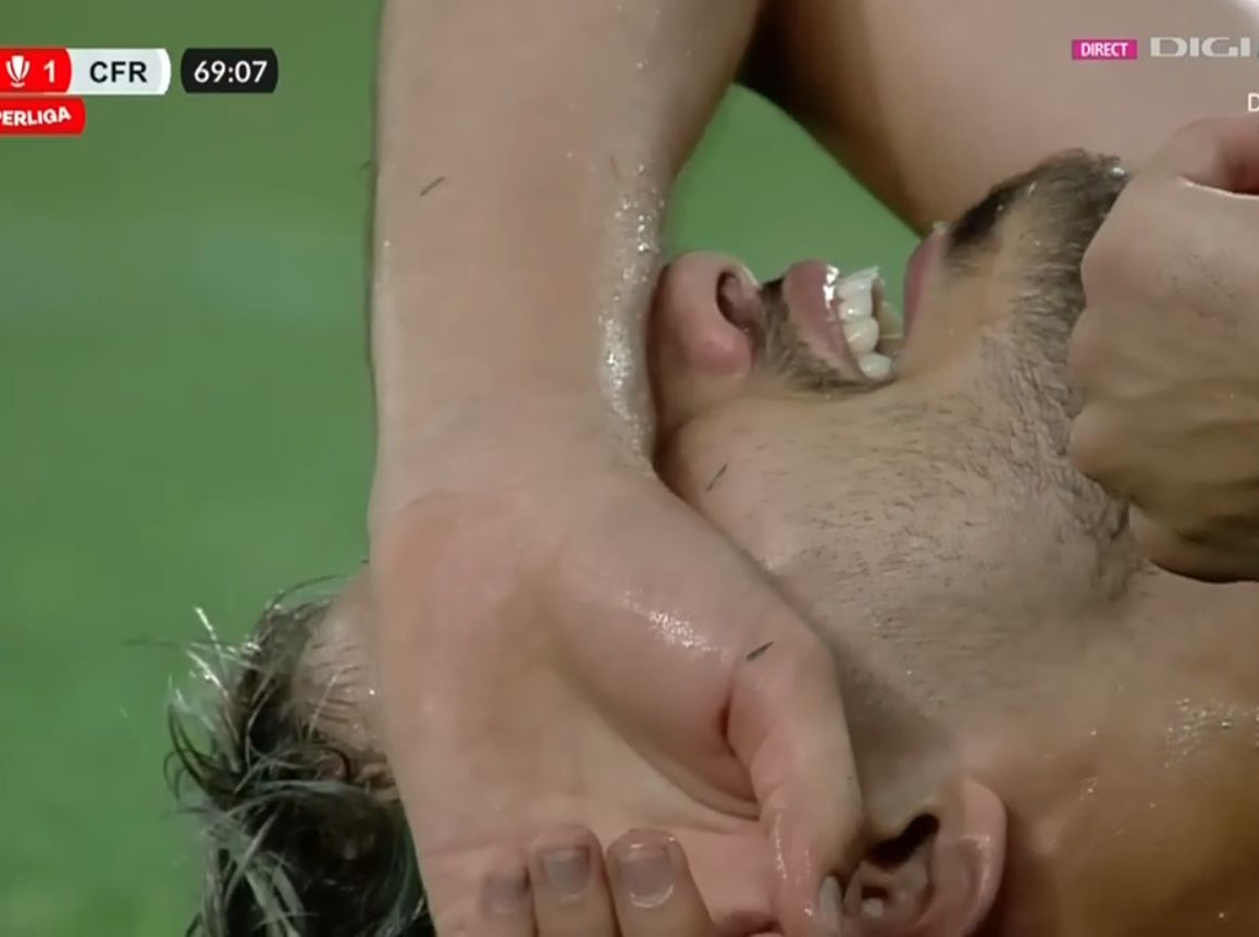 Rapidistul Albion Rrahmani s-a accidentat în meciul cu CFR Cluj