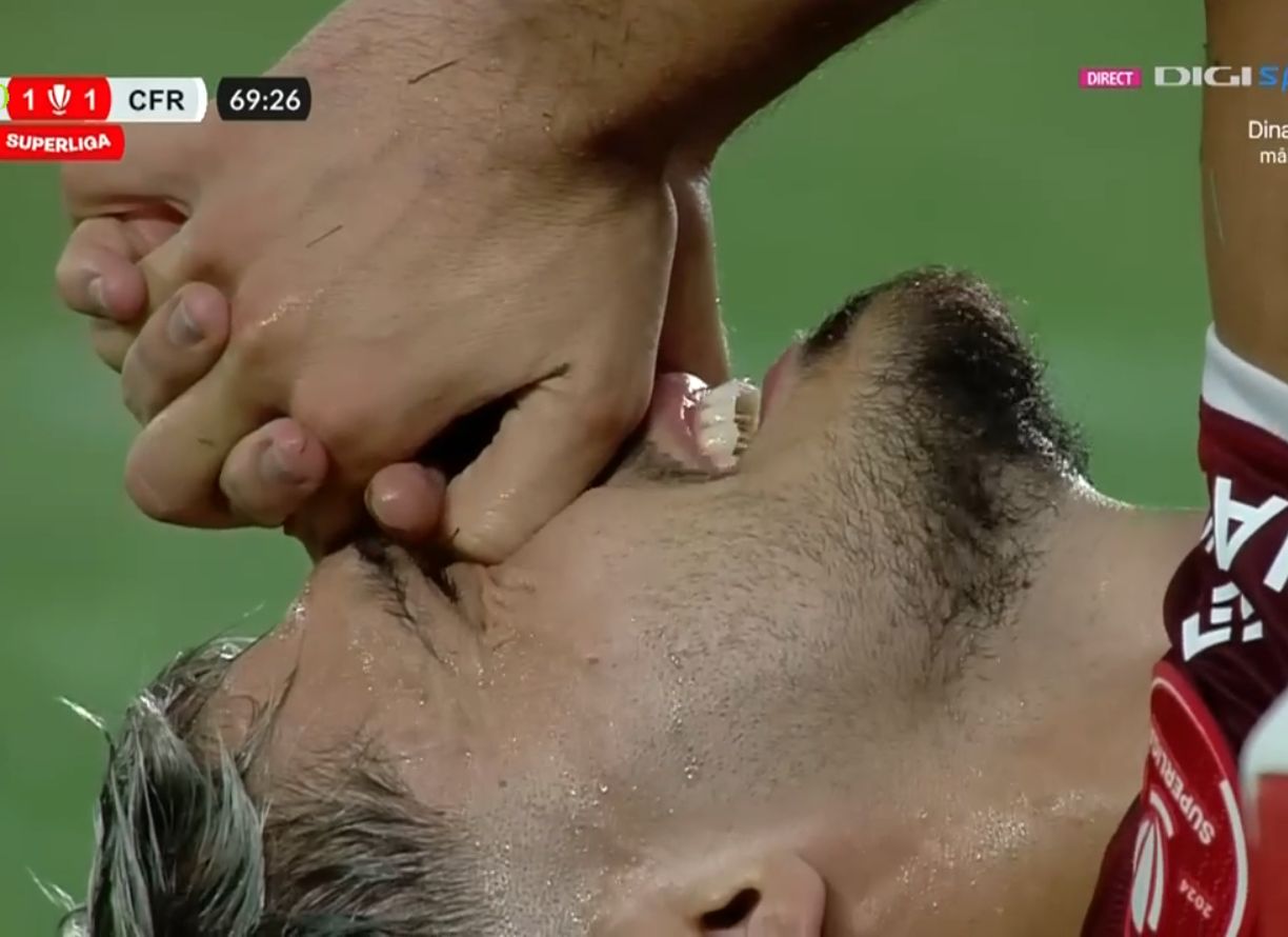 Rapidistul Albion Rrahmani s-a accidentat în meciul cu CFR Cluj
