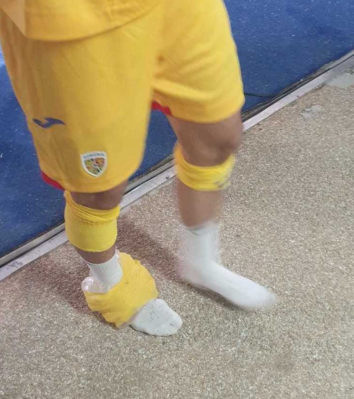 Probleme pentru FCSB Campioanei României i s-a accidentat unul dintre  jucătorii de bază: „Îl doare când merge”