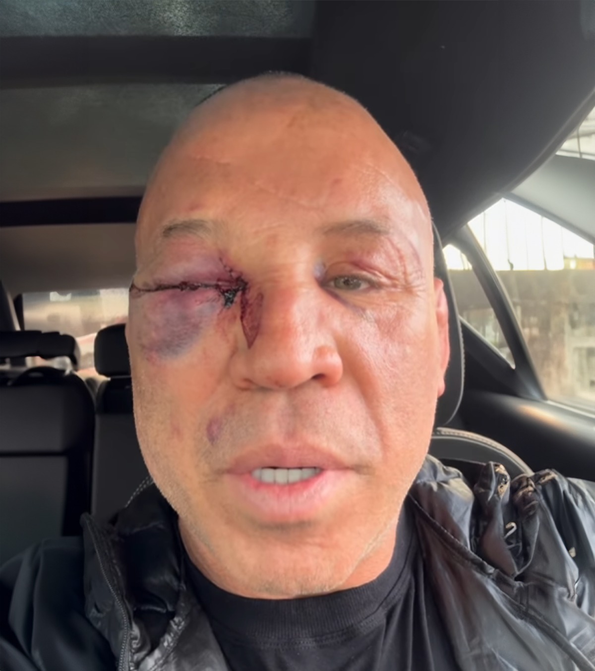 Atacat de fiul adversarului A revenit în ring la 49 de ani și a ajuns la spital după meci! Legenda UFC, lăsată inconștientă de o lovitură brutală