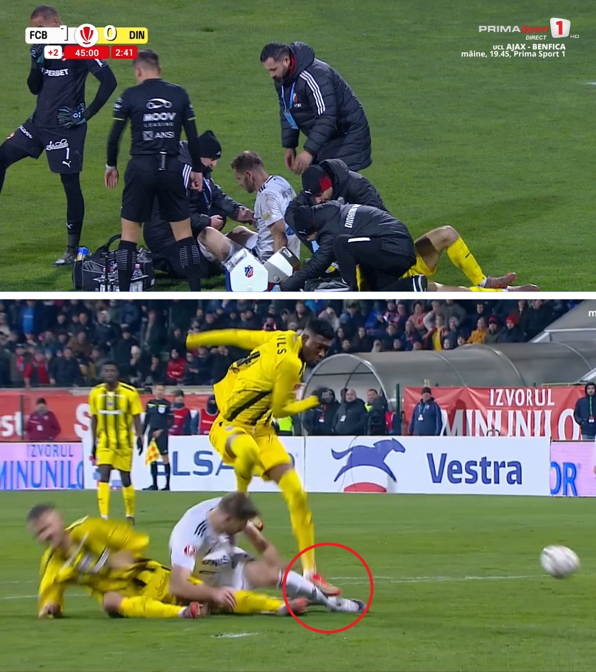 Kovtaliuk, accidentare gravă FOTO: Boateng a scăpat nesancționat după faultul care l-a scos din circuit pe atacantul de la Botoșani: „Scandalos!”