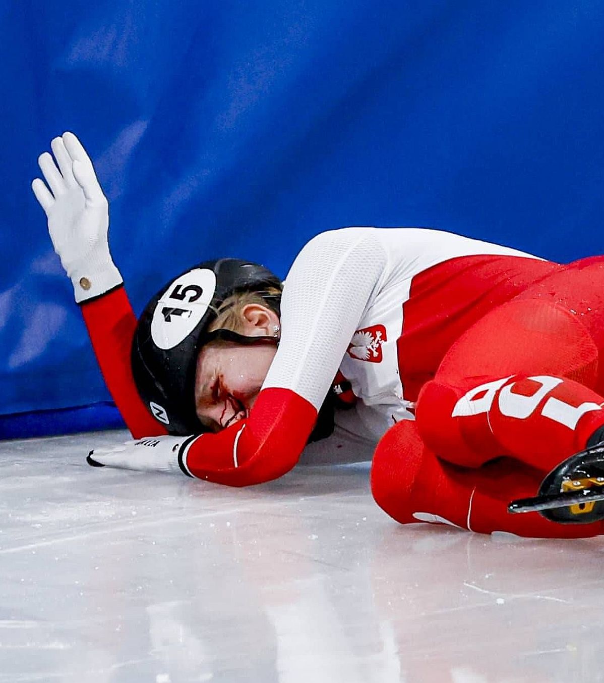 Îngrozitor! FOTO. Accident terifiant la Jocurile Olimpice. Patinatoare lovită la ochi cu lama. Primele vești după operație