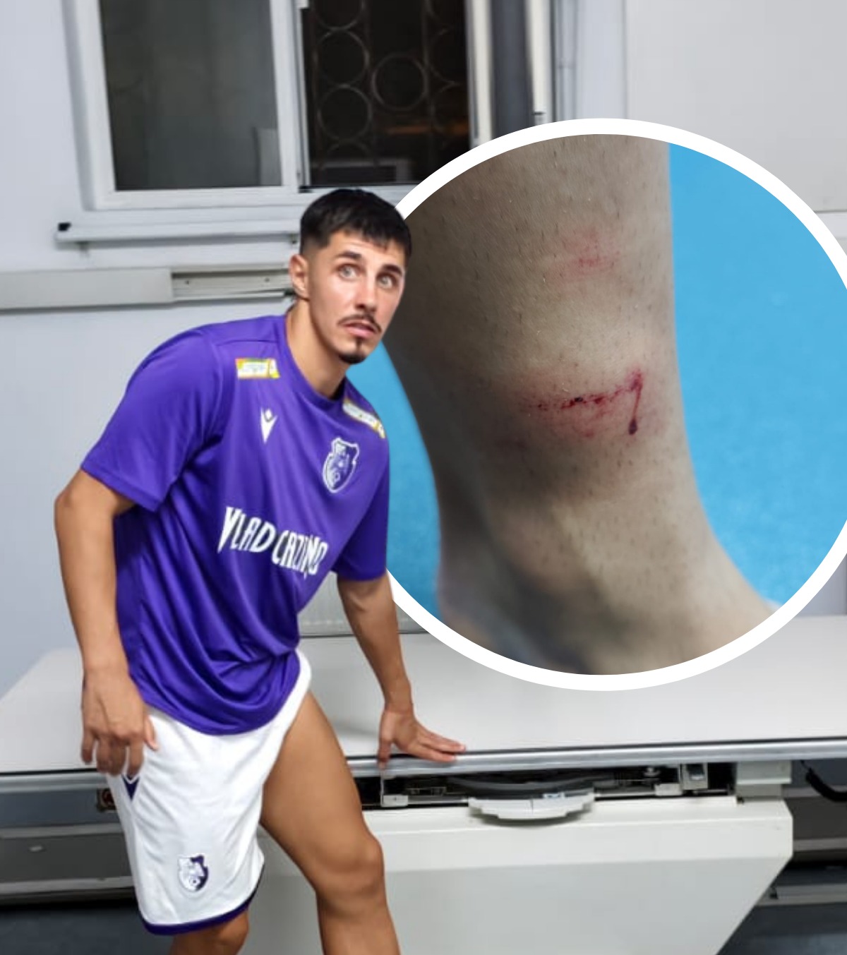 „Se arbitrează în funcție de interese”   FOTO.  Scandal după victoria lui Sepsi!  Borța a ajuns la spital  după intrarea de la faza golului